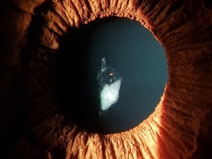 En el FacoArt os mostramos esta foto hecha con un celular Samsung por Patricio Navarro. Nos muestra una catarata polar anterior con restos de membrana pupilar persistente